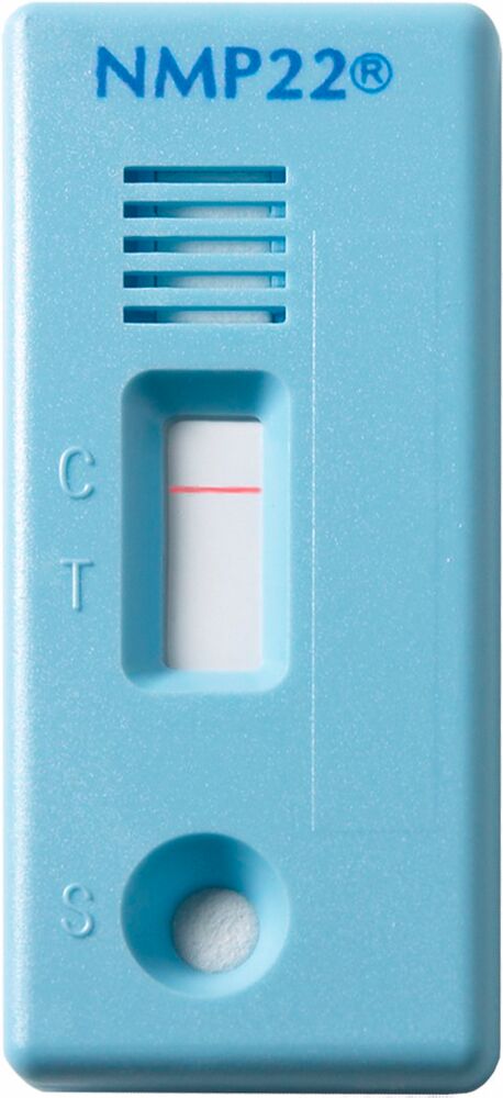 Abbott NMP22® BladderChek® Blasenkrebstest