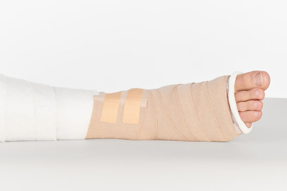 COM-TeX® Derm Rollenpflaster 5 m